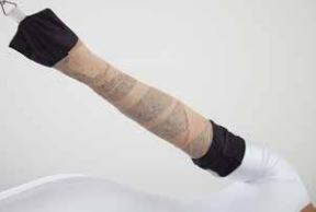 Dr. Don's Northern Arm Suspension Kit: Enhanced Support and Comfort