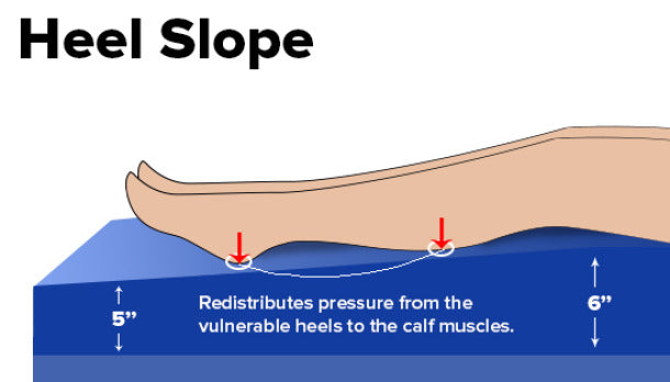 Close-up of Gravity 9 therapeutic foam layers emphasizing heel slope design and channel-cut articulation for long-term patient care