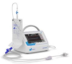 LiquoGuard 7 CSF management system setup with tubing and monitoring components