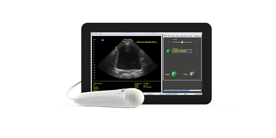 Interson ViewBladder 10 Bladder Scanner with Live Screenshot