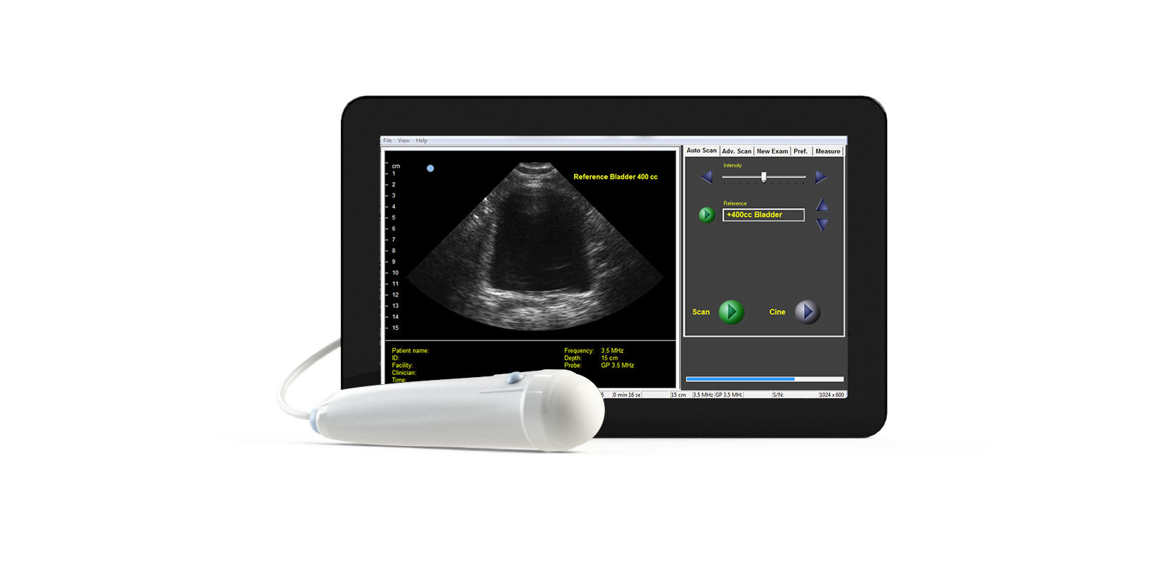 Interson Interson ViewBladder 10 – Portable Bladder Scanner Canada – MedSupply