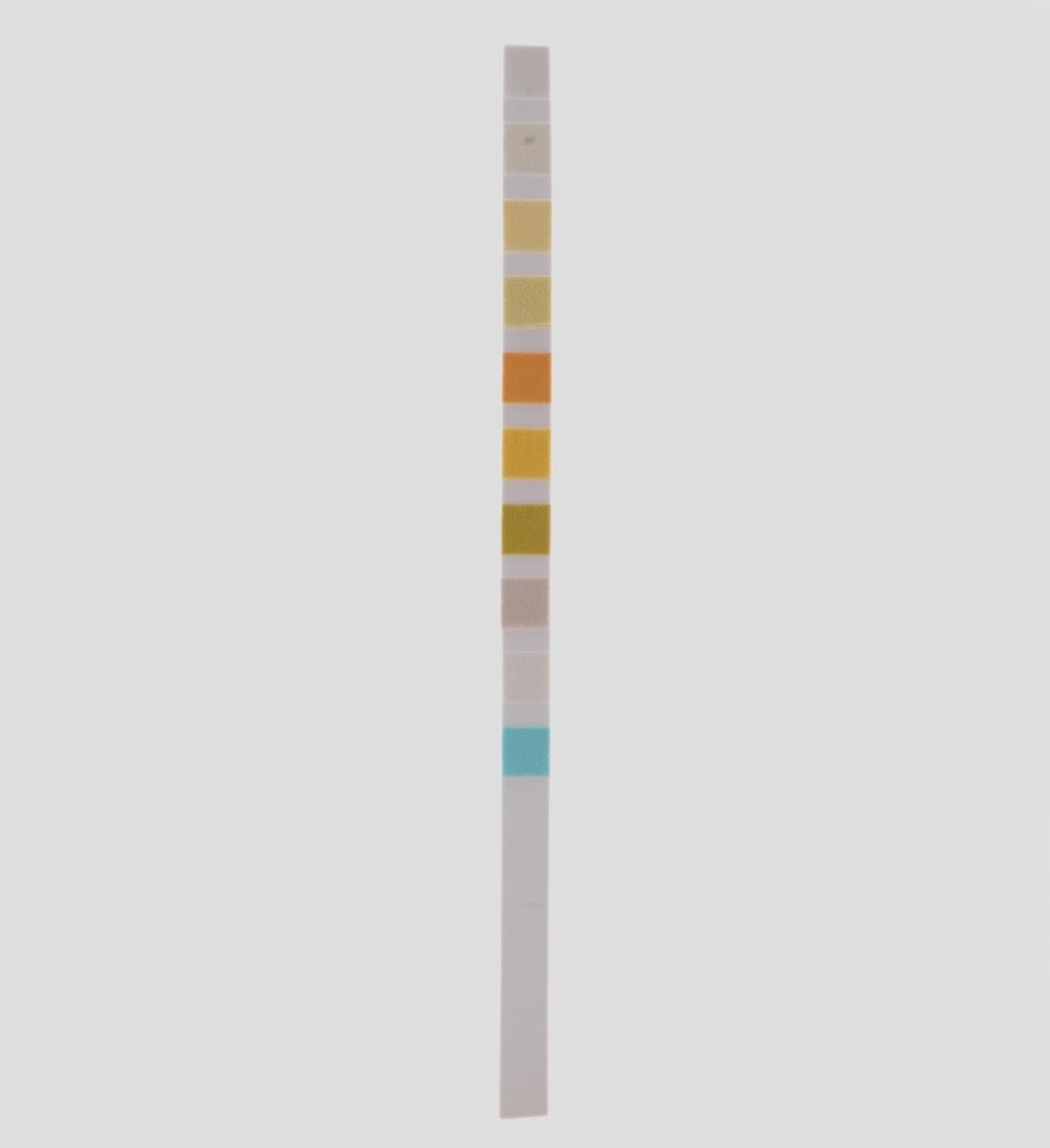 Analyse d'urine à 10 paramètres : bilan de santé complet